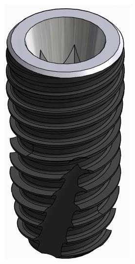 BIONIKA DENTUM, Implant