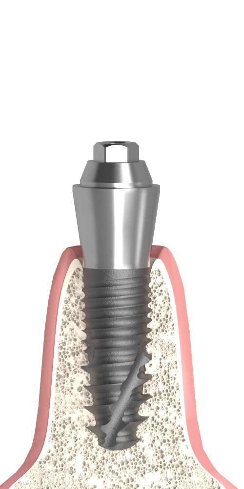 BIONIKA 3I, Multi-unit abutment, straight, screwable, wide, LT2