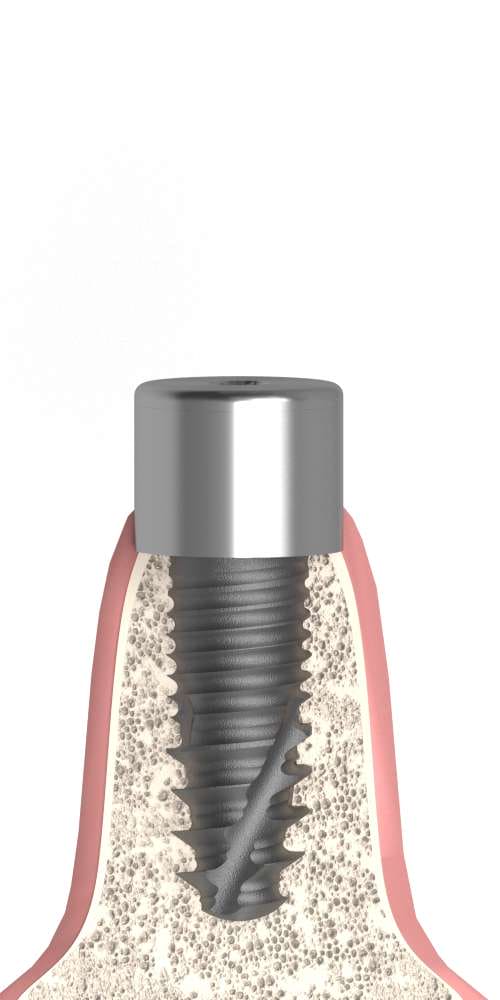 BIOPLANT, Healing abutment, multi-unit level