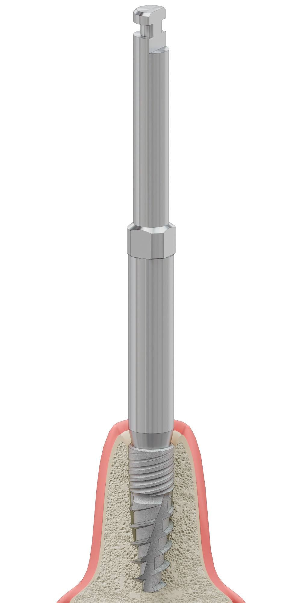 BIONIKA CORTICAL, Implant driver, mechanical, lamellar