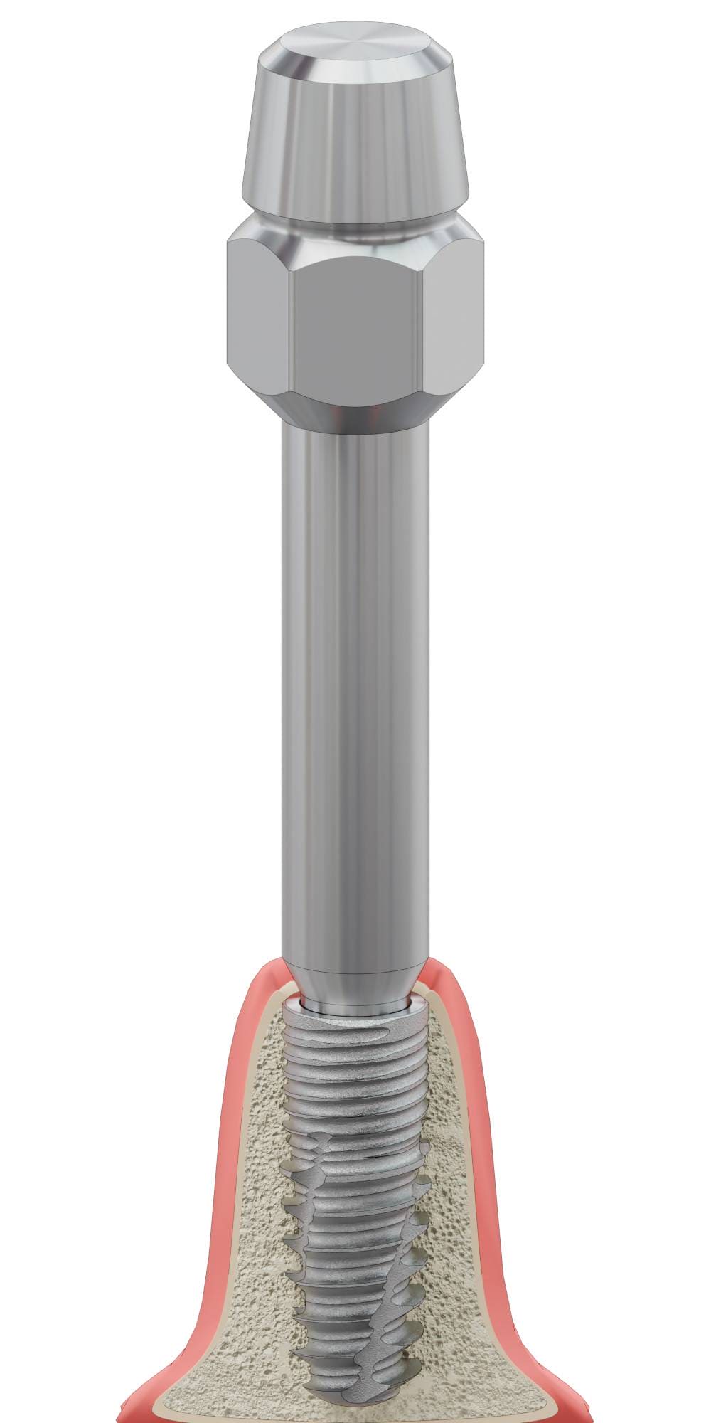 BIONIKA SCANDREA, Implant driver, manual, Bionika