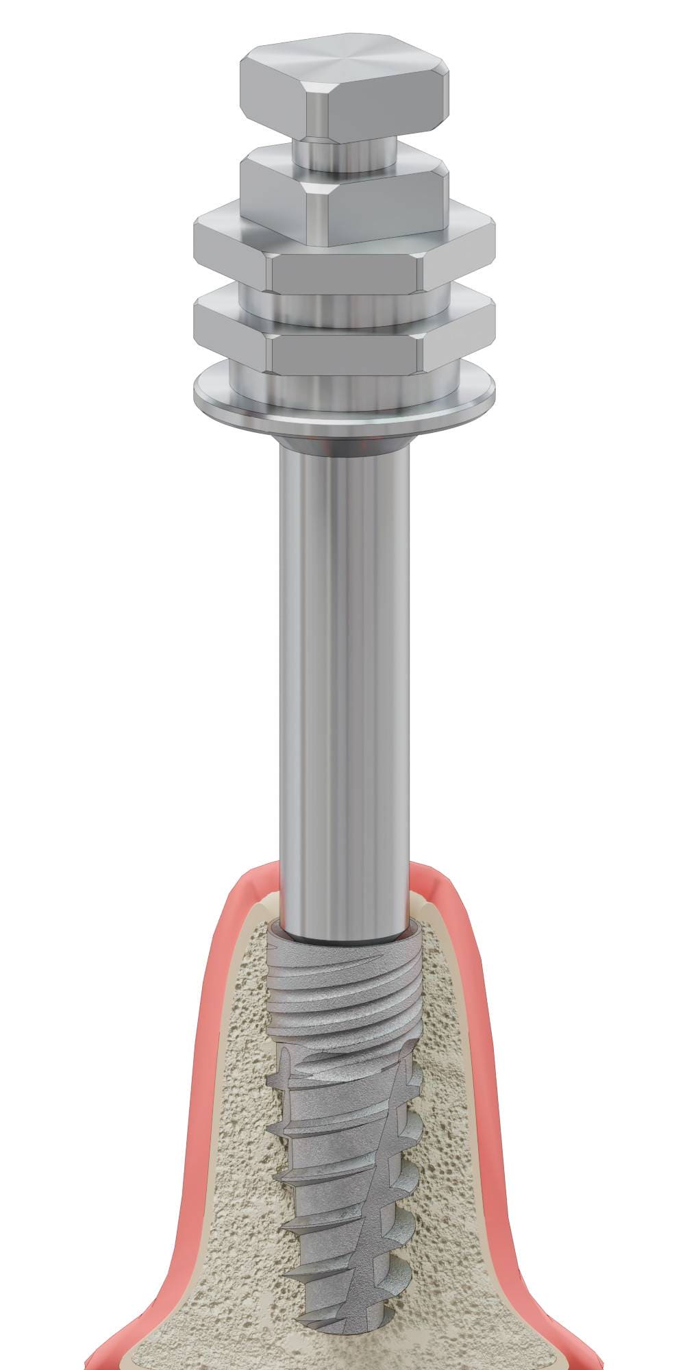 BIONIKA SCANDREA, Implant driver, manual, lamellar, AB