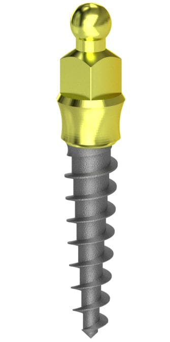 Nanoplant MD implant