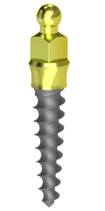 Nanoplant MX implant