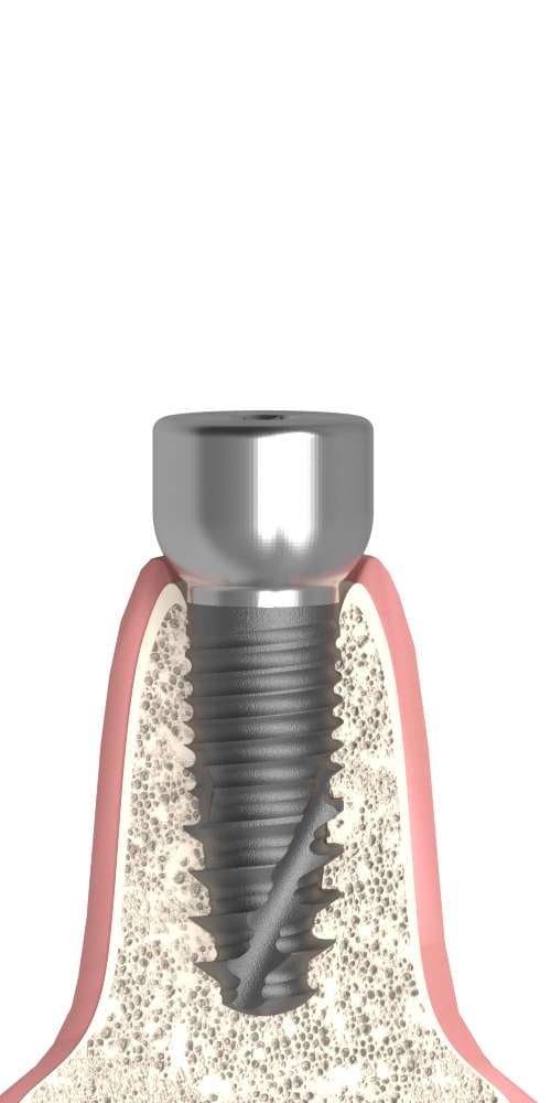 Tiolox® (TLX) Compatible, Healing abutment, anatomical