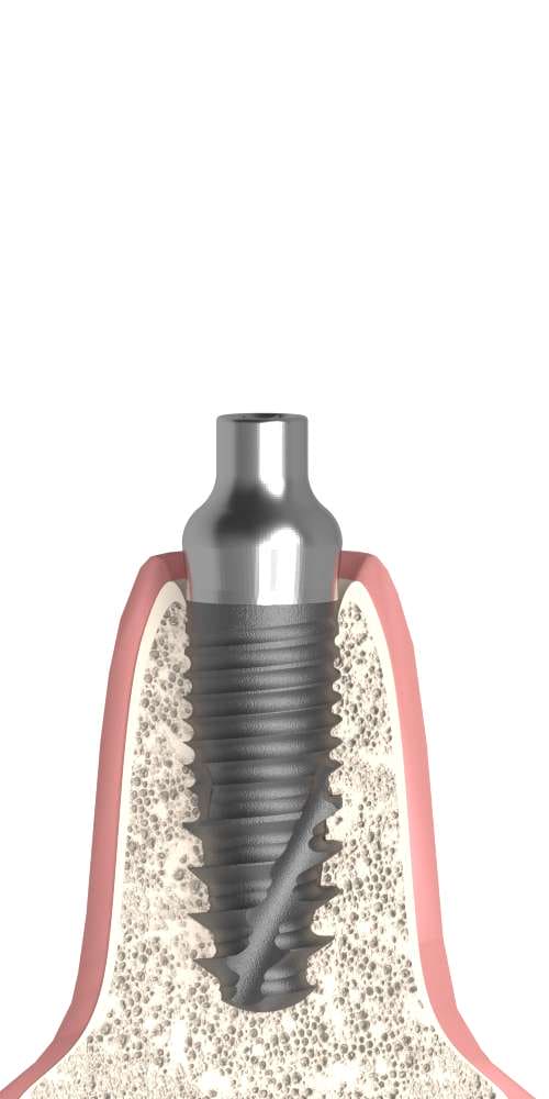 Implant Direct® InterActive® (ID) Compatible, Healing abutment, bottleneck