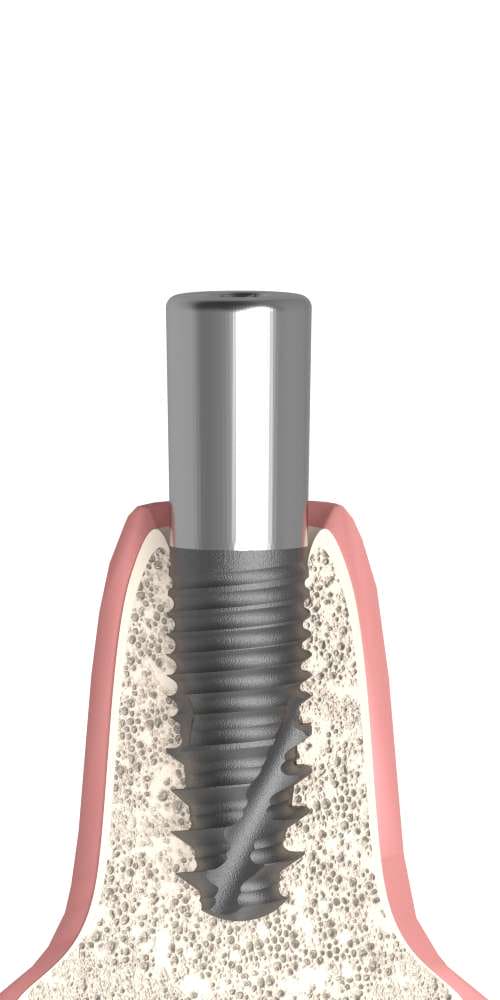 UNIFORM iSy® (iSy) Compatible, Healing abutment, narrow