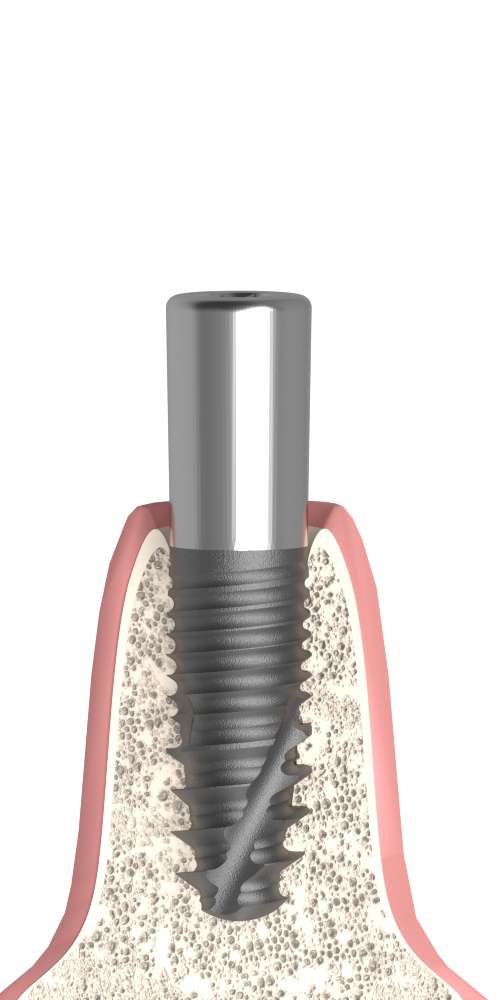 UNIFORM Nobel® Replace® (RP) Compatible, Healing abutment, narrow