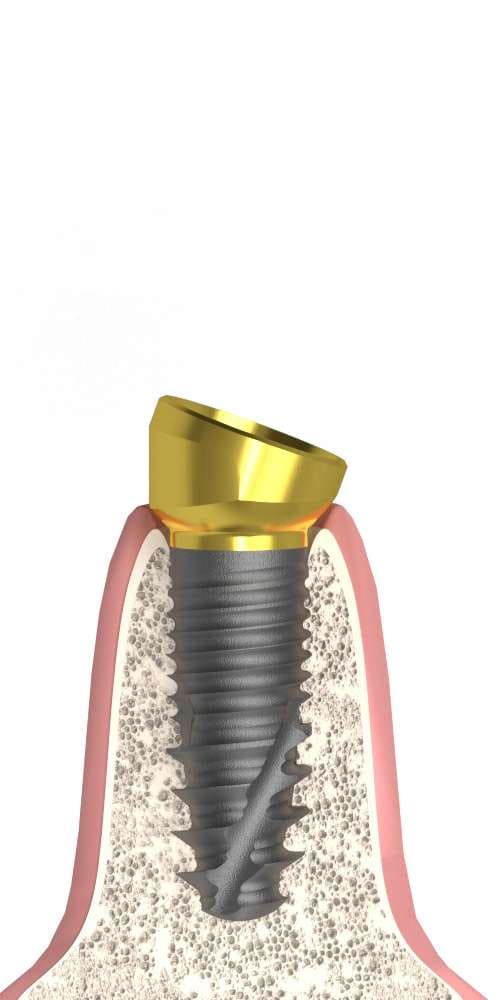 UNIFORM Kontact® (KT) Compatible, Multi-Compact abutment (MC abutment), angled