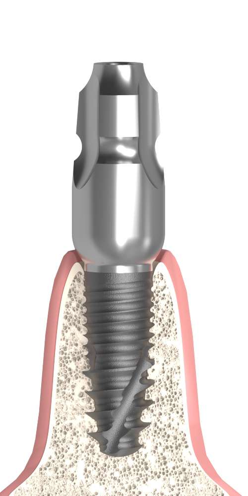 UNIFORM iSy® (iSy) Compatible, Impression coping for closed tray, uniform