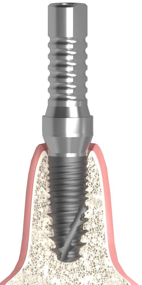 BIONIKA, Temporary abutment, multi-unit level, positioned, LT2.7, wide, M1.6