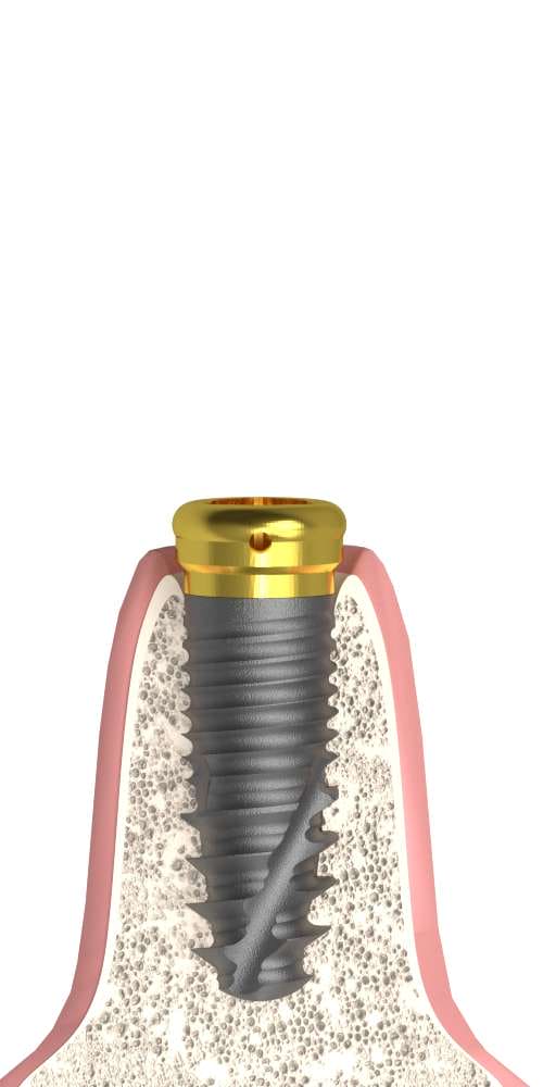 BIONIKA T-REX, Locator abutment, straight