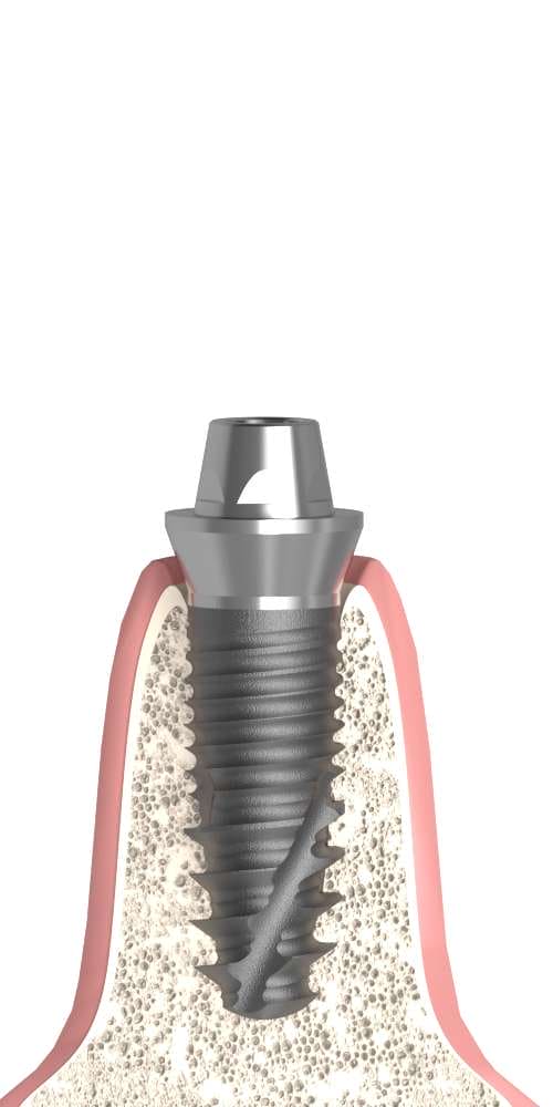 BIONIKA ST, Multi-unit abutment, straight with through screw, positioned, narrow, LT2.7