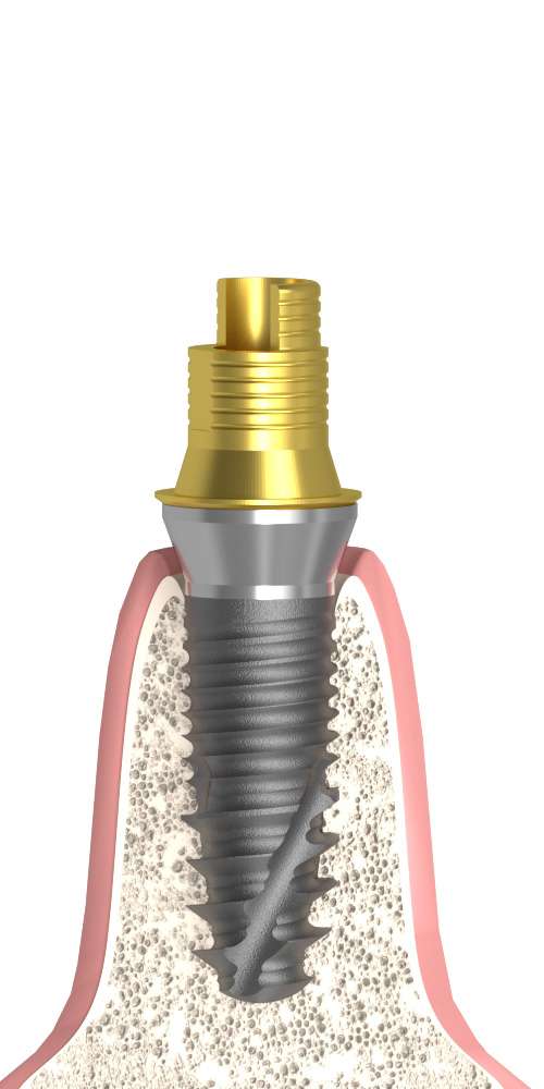 BIONIKA, Flexi base, multi-unit level, non-positioned, LT2, wide, M1.4