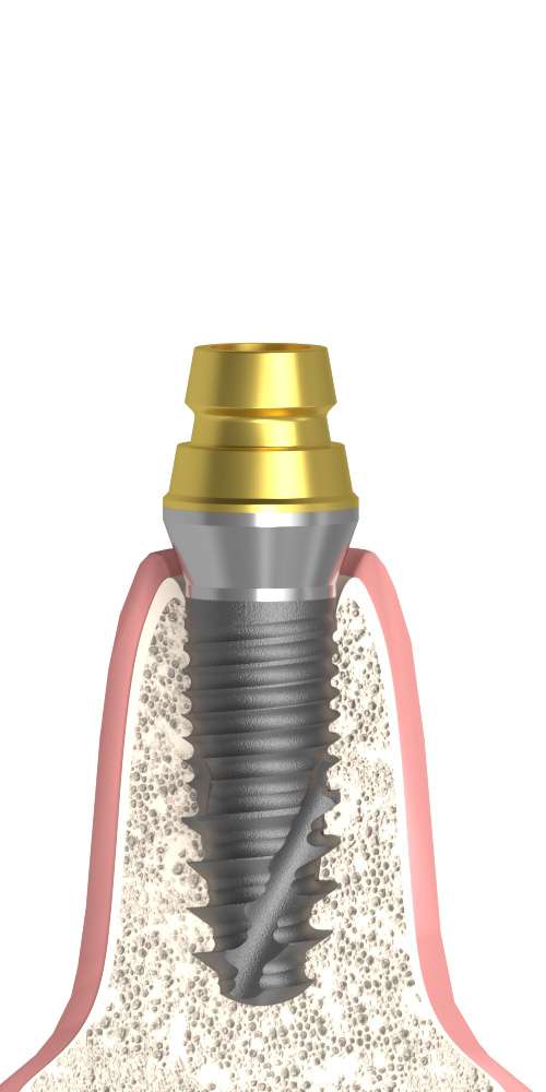 BIONIKA, Titanium base, multi-unit level, positioned, wide, LT2