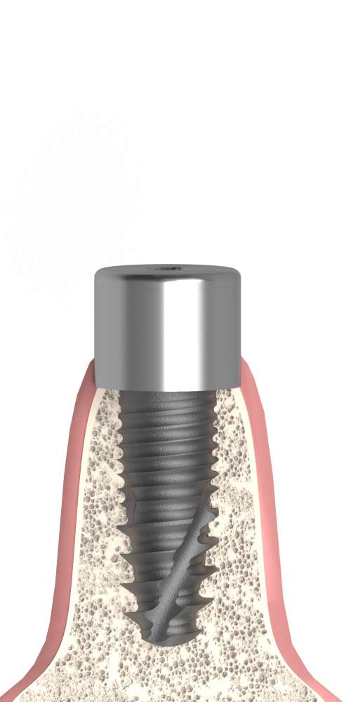 BIONIKA, Healing abutment, multi-unit level, LT2.7, wide, M1.6
