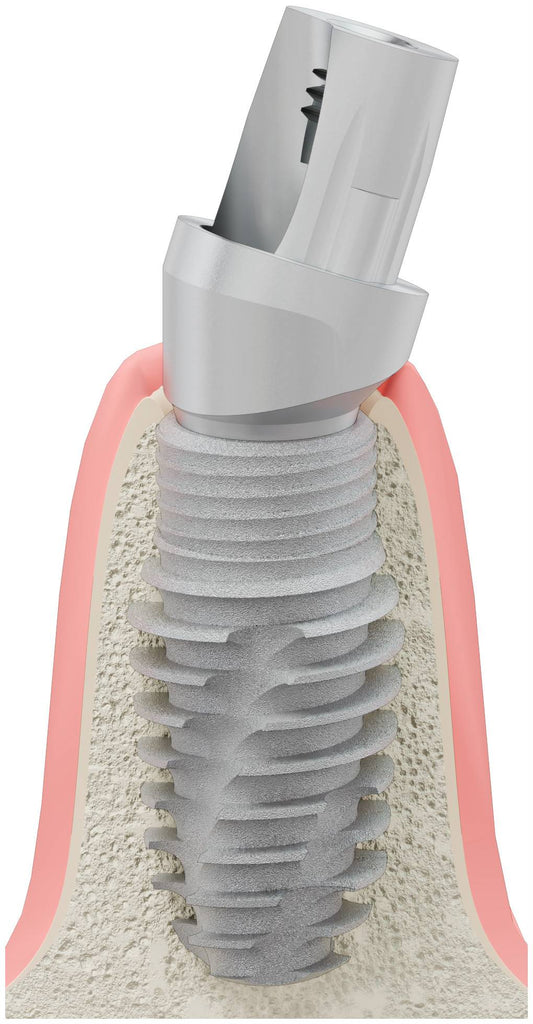 BIONIKA ACTIVAL, Titanium base, angled, positioned, type-B