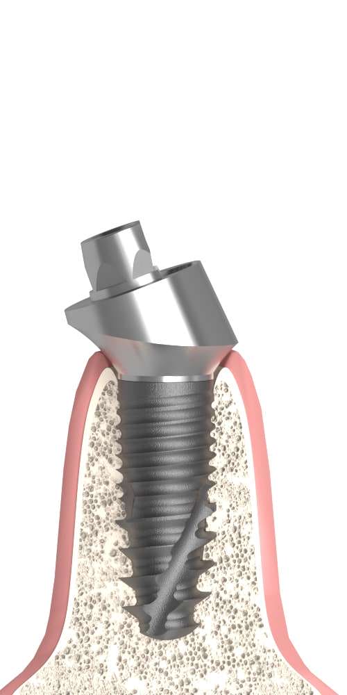 BIONIKA Bonelit Multi-unit abutment, screw retained, angled