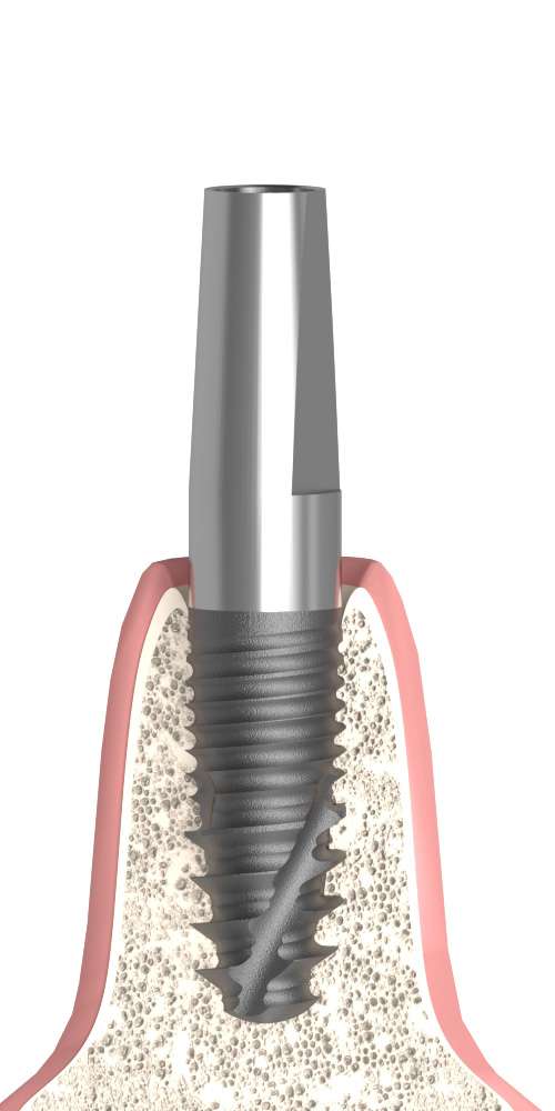 BIONIKA Actival, Narrow abutment, straight