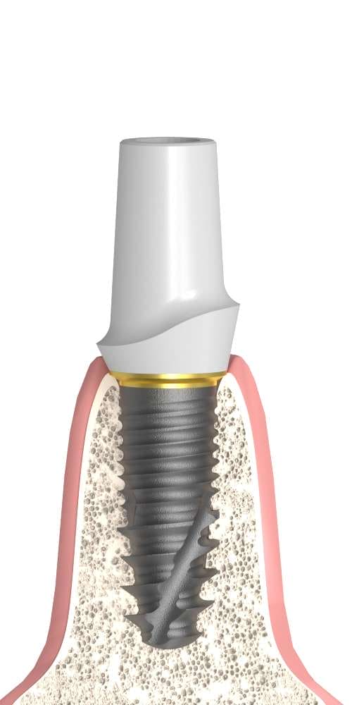 Hicon, Zircon abutment, with titanium base, straight, positioned