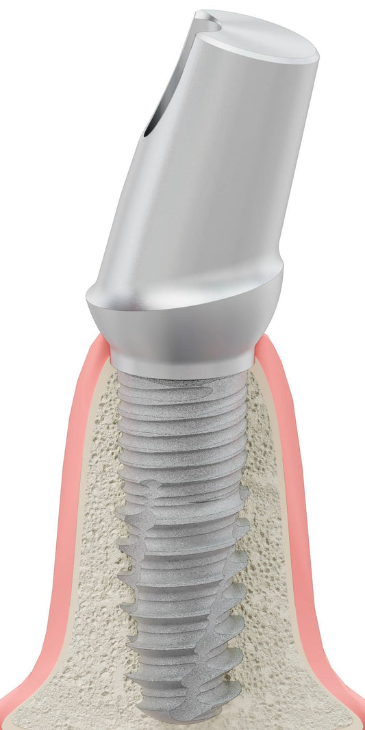 BIOPLANT, Anatomic abutment, angled, 15°, positioned, type-B