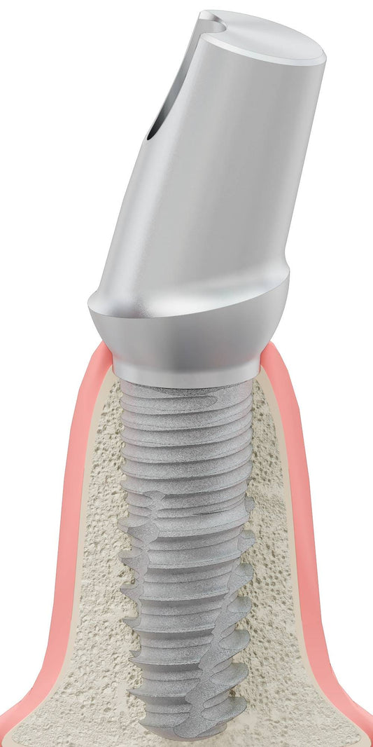 BIONIKA BIOLEVEL, Anatomic abutment, angled, 15°, positioned, type-B