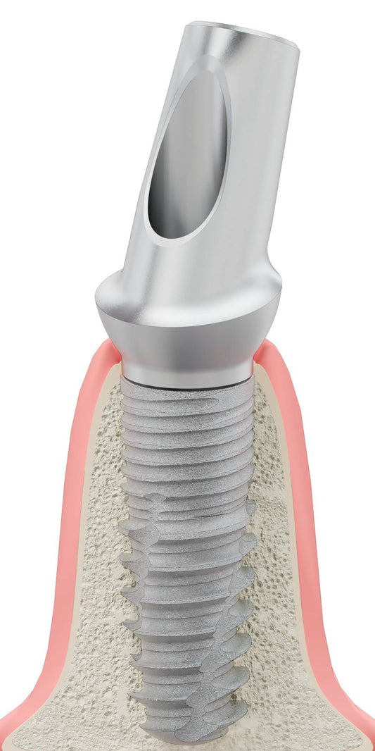 BIONIKA T-REX, Anatomic abutment, angled, 25°, positioned, type-A