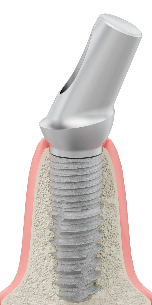 BIONIKA T-REX, Anatomic abutment, angled, 25°, positioned, type-B