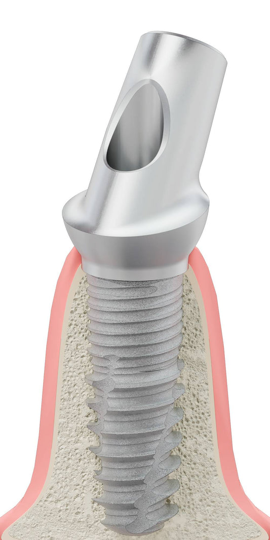 BIONIKA T-REX, Anatomic abutment, angled, 35°, positioned, type-A