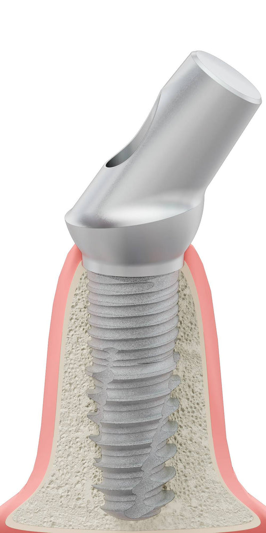 BIONIKA T-REX, Anatomic abutment, angled, 35°, positioned, type-B