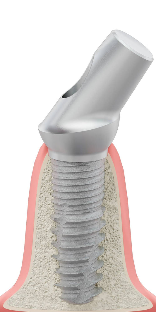 BIONIKA ST, Anatomic abutment, angled, 35°, positioned, type-B