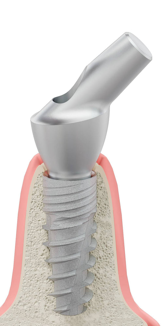CORTILOG CCL, Anatomic abutment, angled, 45°, positioned, type-B