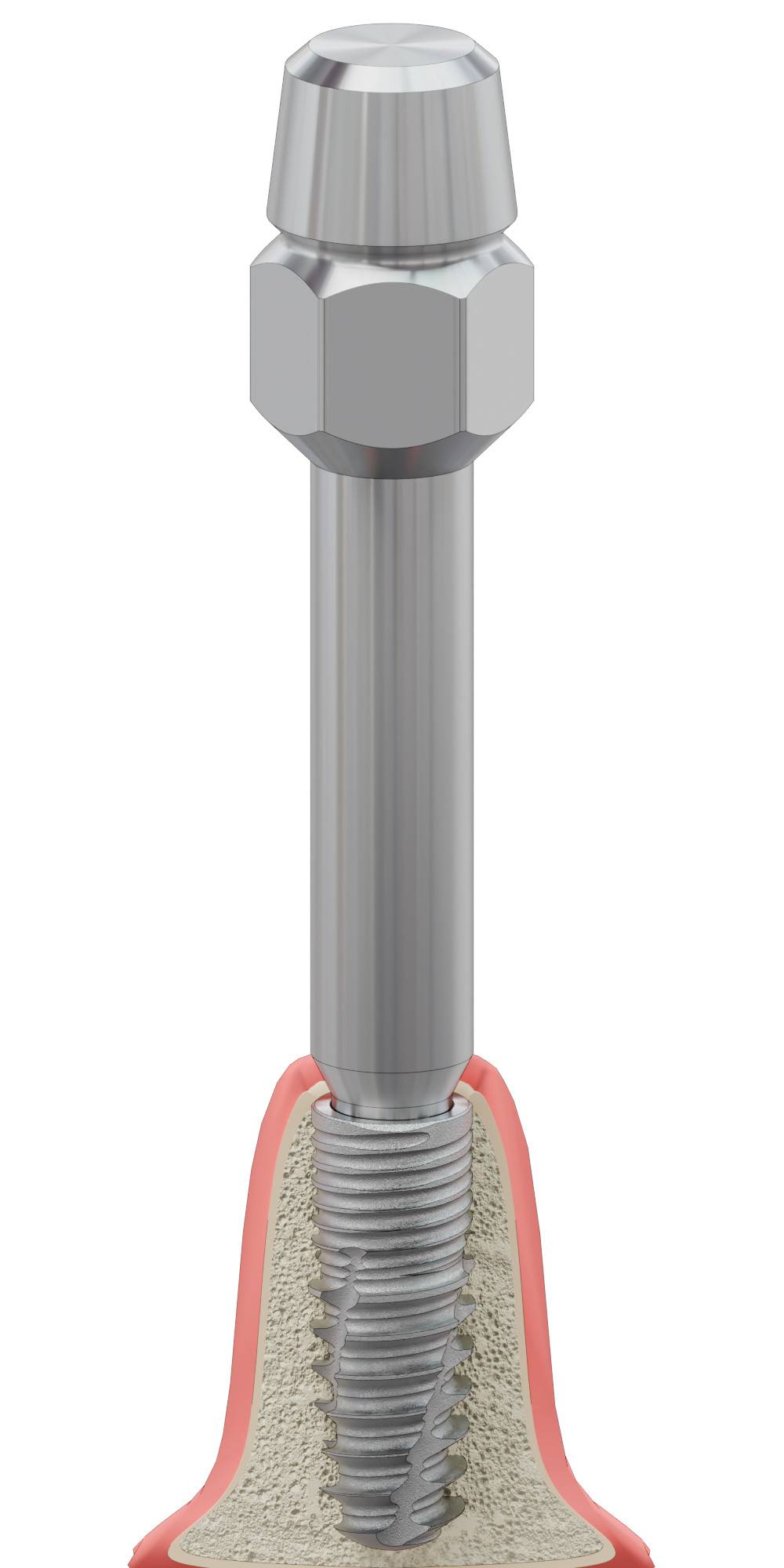 BIONIKA ACTIVAL, Implant driver, manual, Bionika