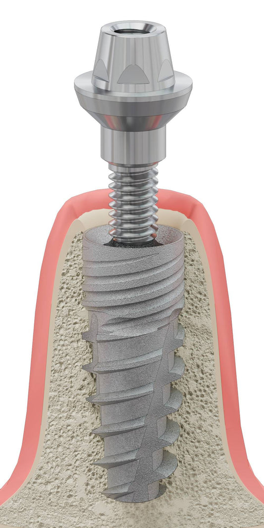 BIOPLANT, Multi-unit abutment, straight, screwable, wide