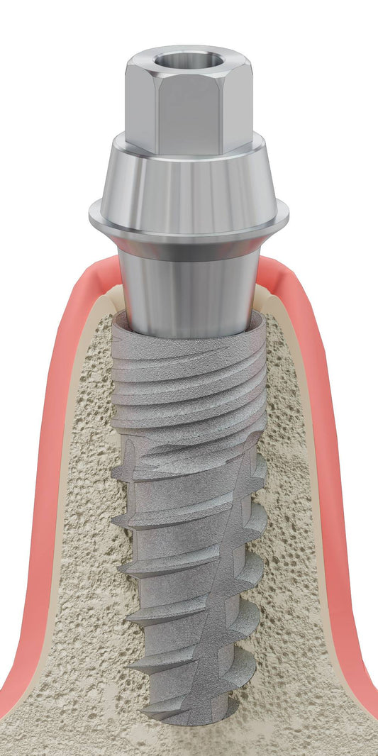 BIONIKA T-REX, Multi-unit SR abutment, with through screw, positioned