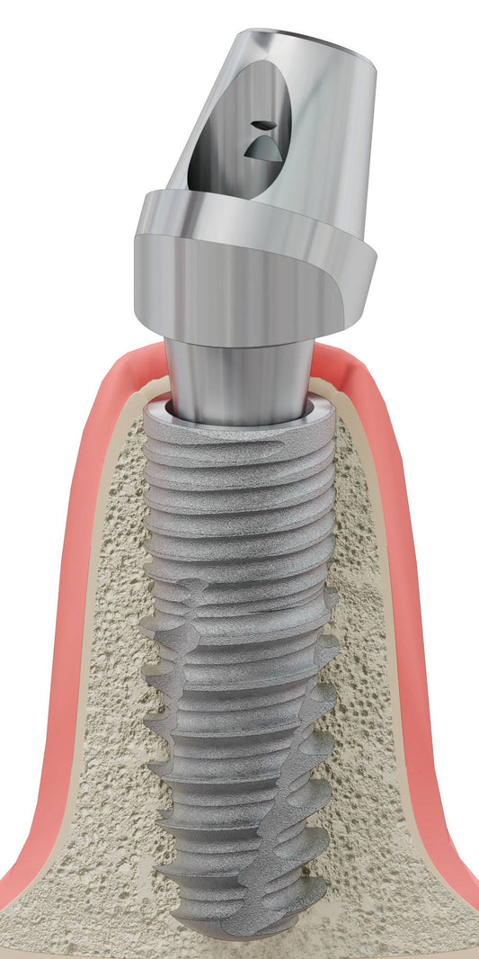 CORTILOG CCL, Multi-unit SR abutment, angled, positioned, type-B