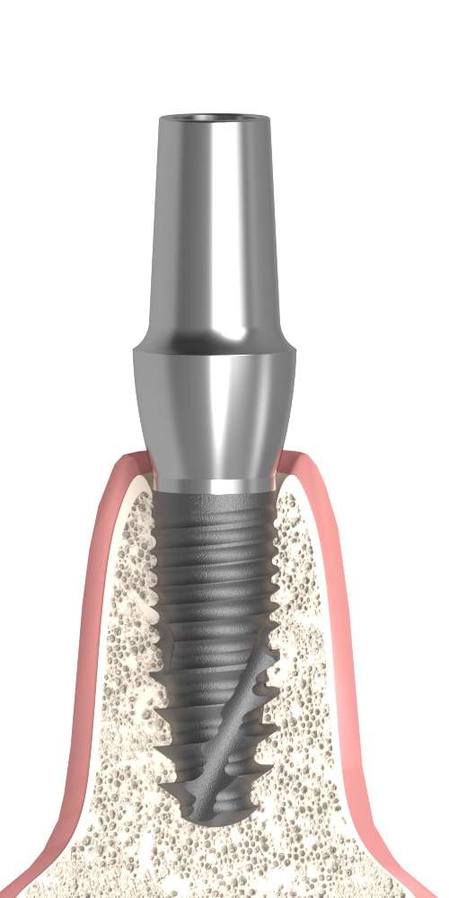 Amelo® (AM) Compatible, Anatomical abutment, straight