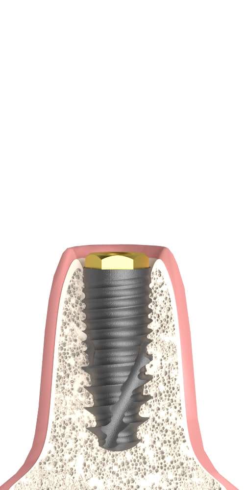 Dentium® Superline (DM) Compatible, BR interface, implant level, positioned