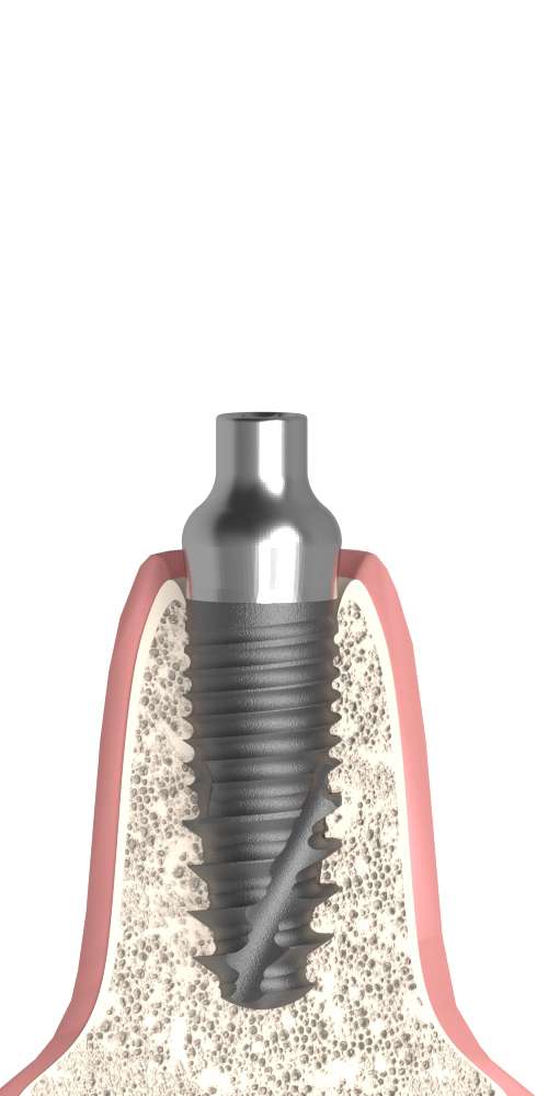 Cosmodent® (CD) Compatible, Healing abutment, bottleneck