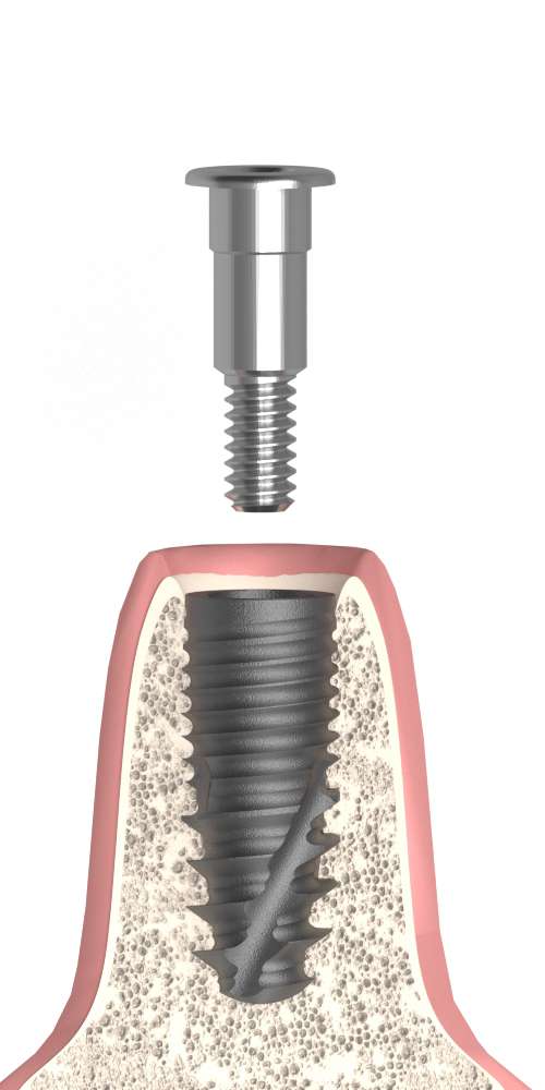 Dentium® NR Line (DN) Compatible, Cover screw