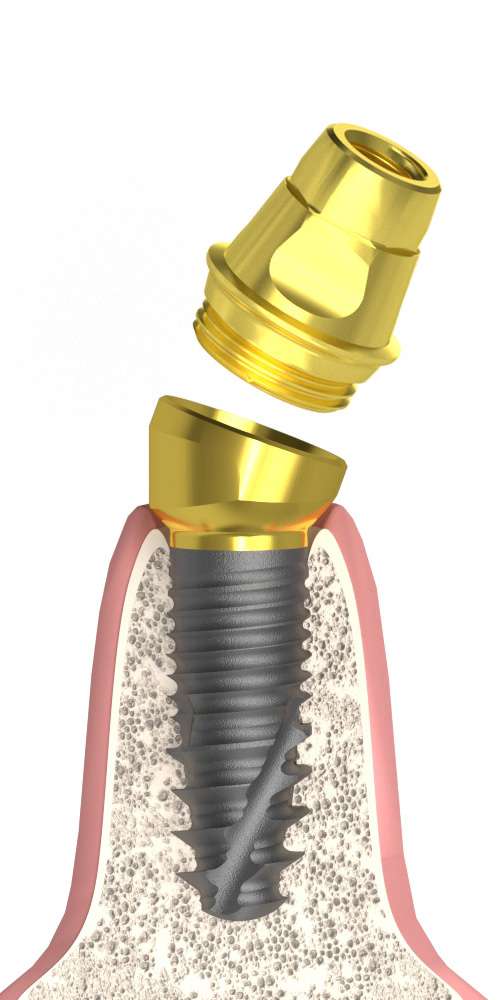 Nobel® Replace® (RP) Compatible, Multi-Compact abutment (MC abutment), oblique, with M1.6 SR cone