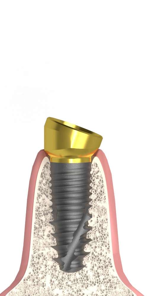 Implant Direct® InterActive® (ID) Compatible, Multi-Compact abutment (MC abutment), oblique