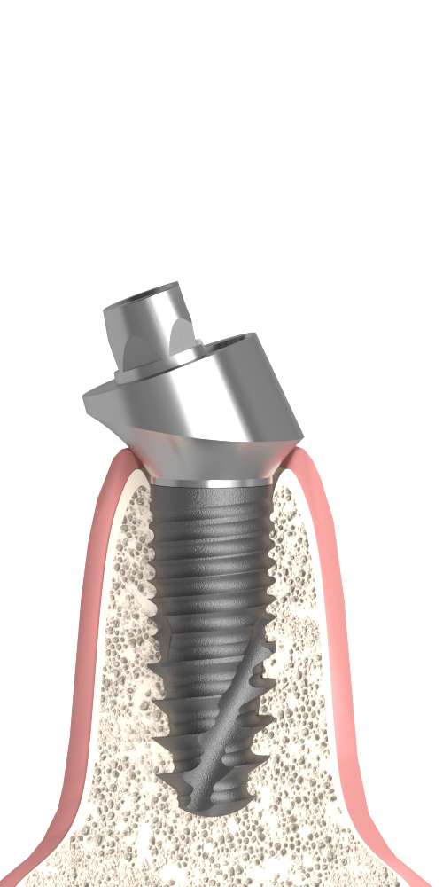 Nobel® Brånemark® (BR) Compatible, Multi-unit abutment, oblique, through-bolted