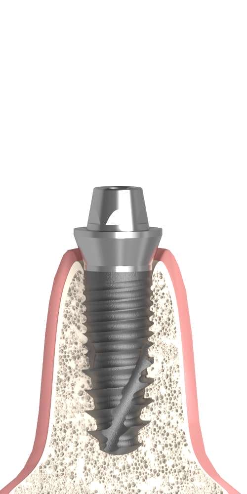 Hicon, Multi-unit abutment, screw retained