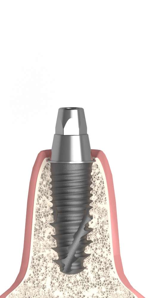 Implant Direct® InterActive® (ID) Compatible, Multi-unit SR abutment, straight, screwable