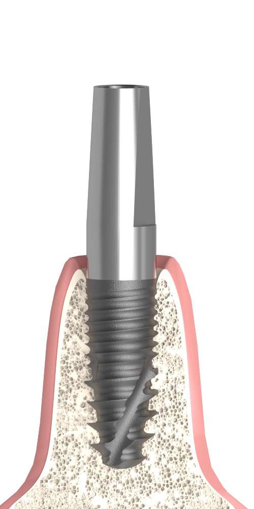 Uniplant® (UP) Compatible, Narrow abutment, straight