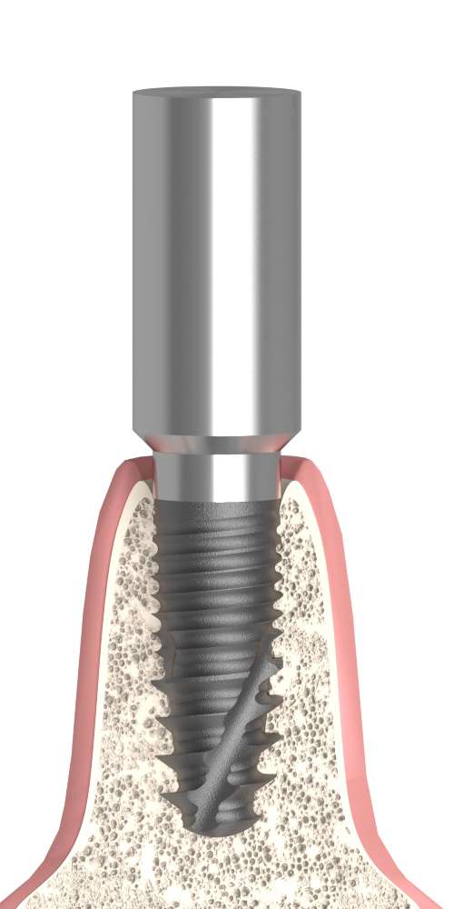 DenTi® Root Form® (DT) Compatible, Scan body, screwable, non-positioned