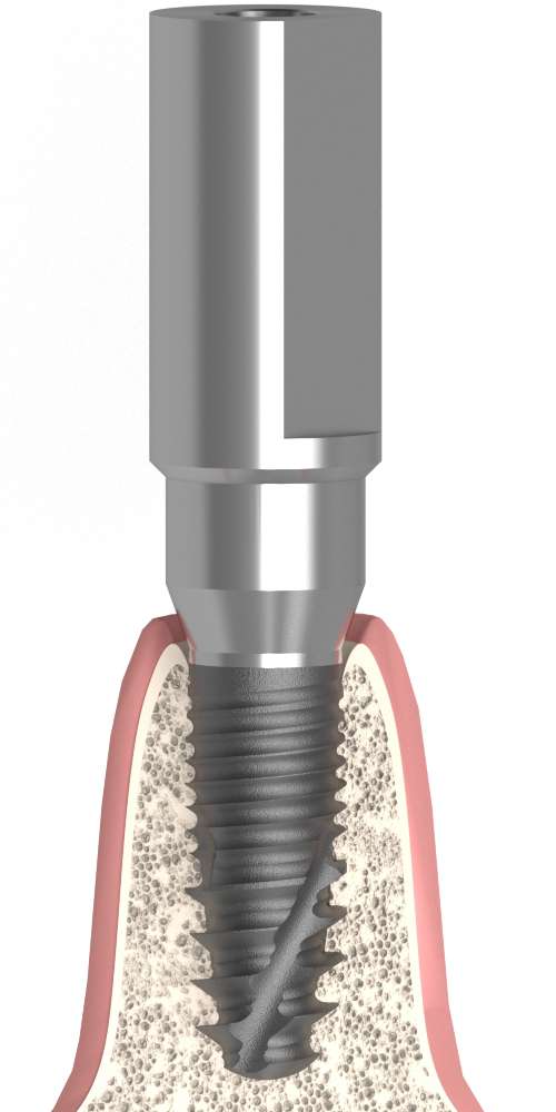 UNIFORM Dentium® Superline (DM) Compatible, Scan body, through-bolted, Multi-unit level, positioned