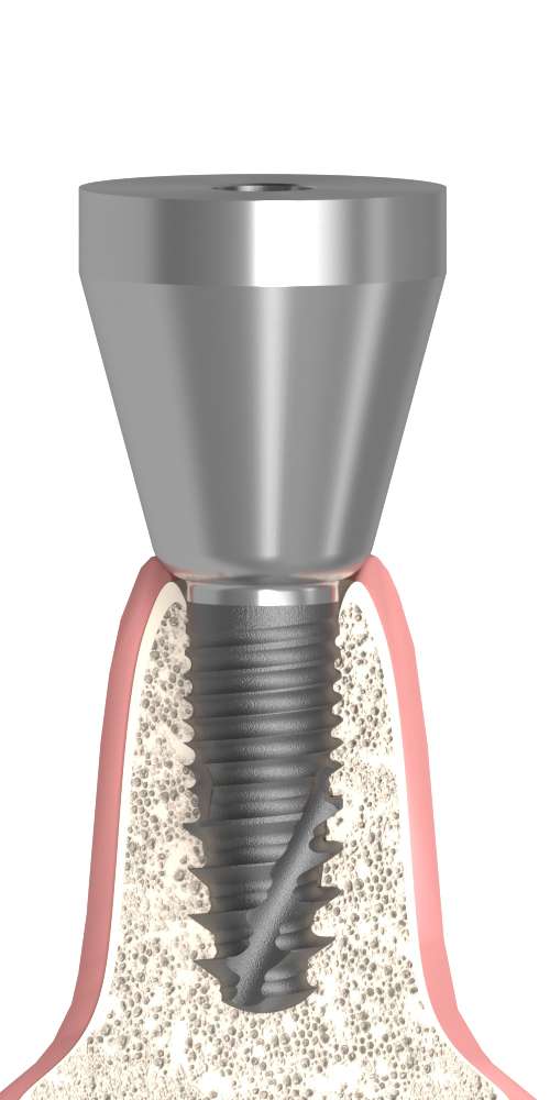 Oralplant® (OR) Compatible, Trapezoidal abutment