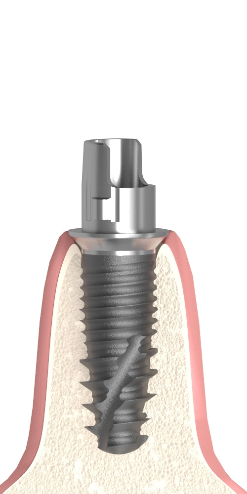 Dentum, Titanium base, PCT stepped, implant level, positioned